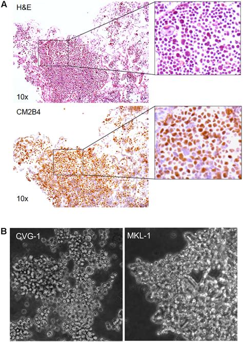 Frontiers | Characterization of a Merkel Cell Polyomavirus-Positive Merkel Cell Carcinoma Cell ...