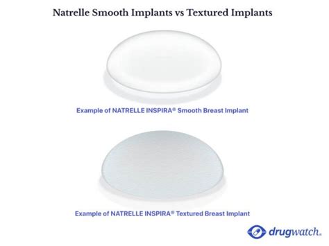 Allergan Breast Implant Recalls | List of Affected Models