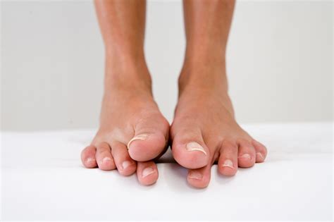 Body Image: Do You Hate Your Feet Enough to Get Plastic Surgery on Your Toes? | Glamour