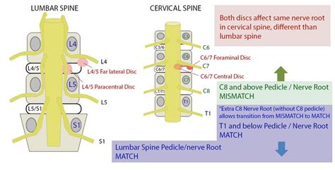 Lumbar Spine Anatomy - Spine - Orthobullets