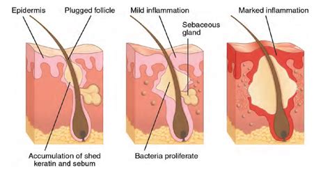 Integumentary System – Building a Medical Terminology Foundation