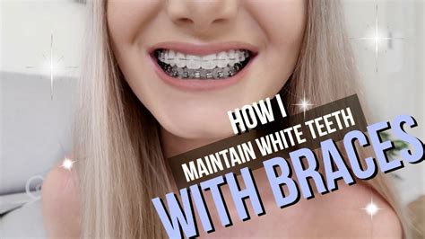 do teeth whitening strips work with braces - Terica Medley