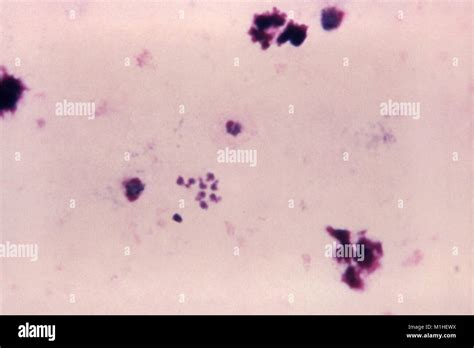 Photomicrograph of the malaria parasite Plasmodium ovale in various ...