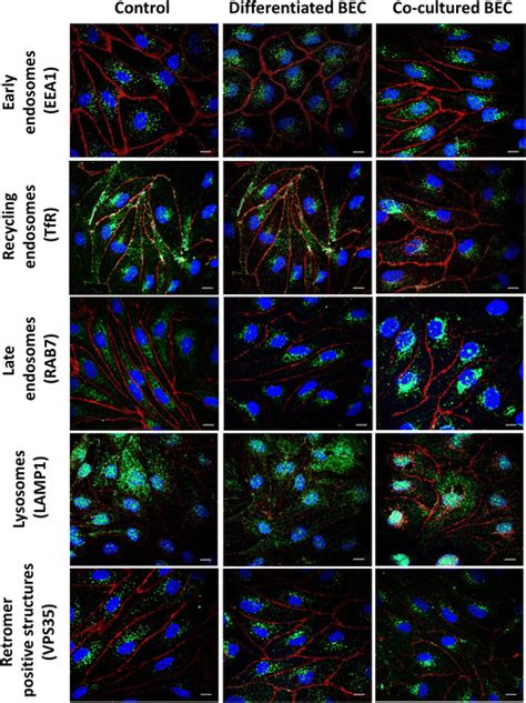 Immunofluorescence staining against endosomal markers in control,... | Download Scientific Diagram