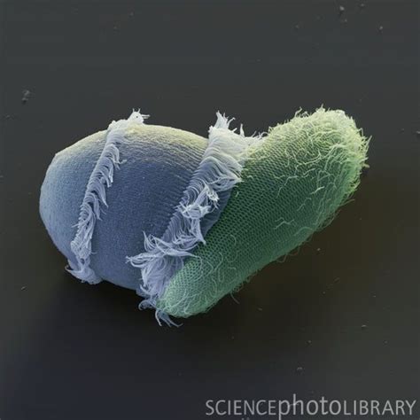 Didinium attacking Paramecium - Stock Image Z105/0219 | Microscopic ...