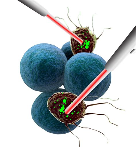 photodynamic therapy cancer treatment | Adult Stem Cell Therapy Abroad, Stem Cell Clinic in Thailand