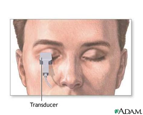 Eye and orbit ultrasound Information | Mount Sinai - New York