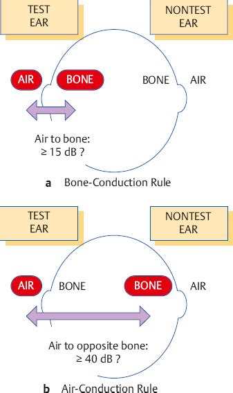 Clinical Masking | Ento Key