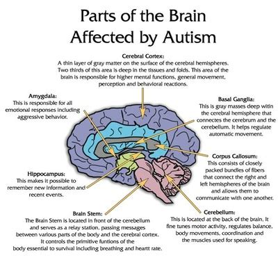 Autism or Kanner's Syndrome (classic autistic disorder) - disability speaks website