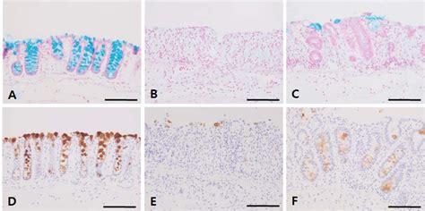 Alcian blue-positive goblet cells (A, B and C) and expression of Mucin2 ...