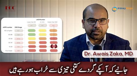 Kidney Disease Stages | CKD Heat Map | Dr. Awais Zaka, MD | Expert Consult Clinic | Episode 06 ...