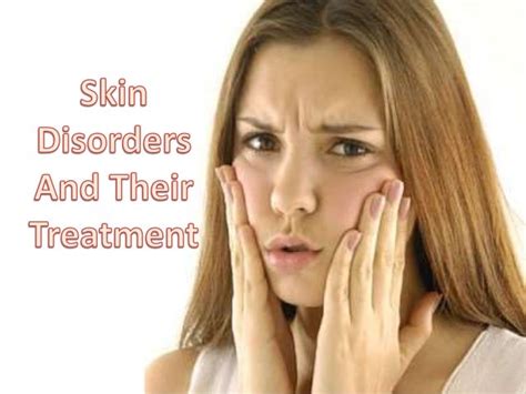 Skin disorders and their treatment