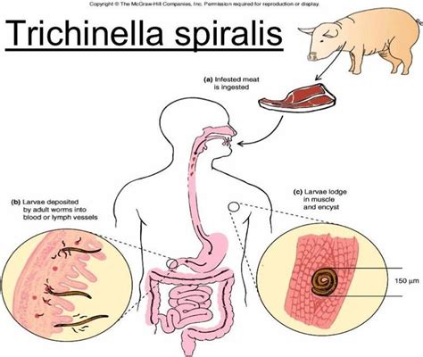 trichinella spiralis - Google 검색 | Lymph vessels, Life cycles, Microbiology