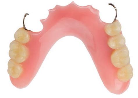 Partial Dentures - Drysdale Denture Services