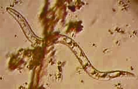 Entomopathogenic nematodes and Their Enterobacteria Symbionts as agents of Termite Control ...