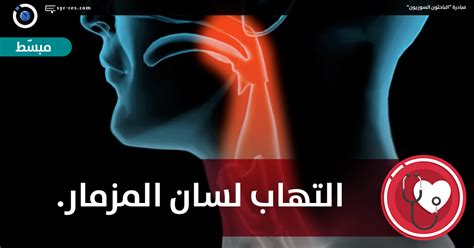 الباحثون السوريون - التهاب لسان المزمار Epiglottitis