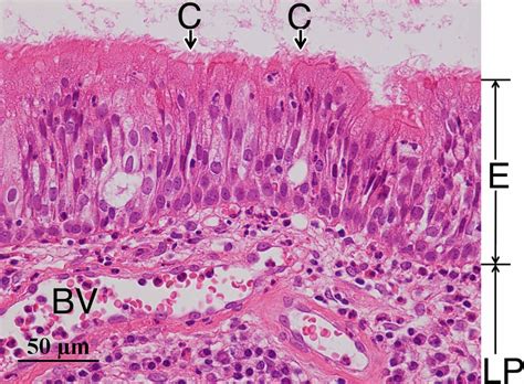 Histopathology of maxillary sinus mucosa with odontogenic maxillary ...