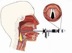 Assessment - Vocal Nodules