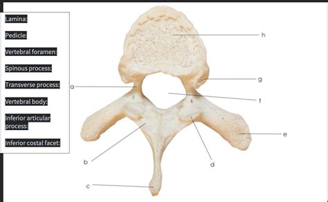 Solved Lamina: Pedicle: h Vertebral foramen: Spinous | Chegg.com