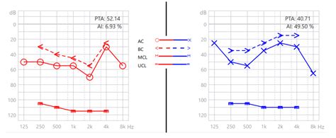 Interpreting audiogram BC symbols