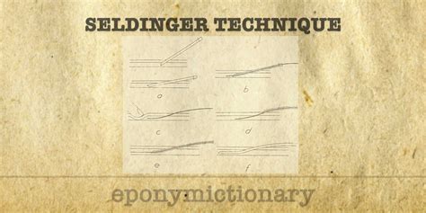 Seldinger Technique • LITFL • Medical Eponym Library