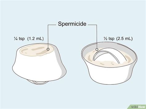 How to Use a Cervical Cap - wikiHow