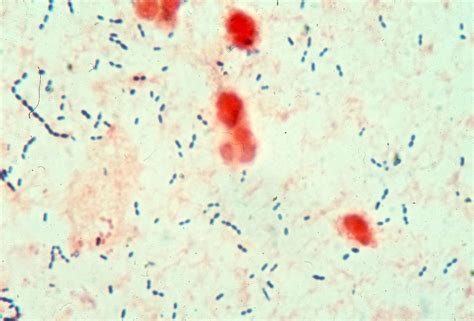 Streptococcus pneumoniae | Streptococcus pneumoniae, Microbiology ...