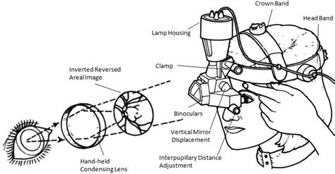 Conventional binocular indirect ophthalmoscope (BIO) (a) and portable ...