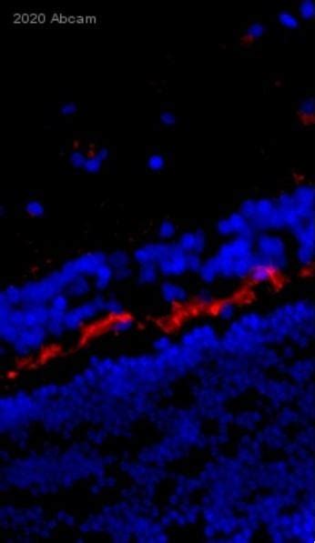 Anti-LAMP1 antibody - Lysosome Marker (ab24170) | Abcam