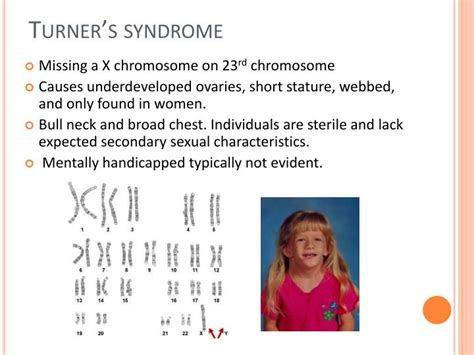 PPT - Karyotype PowerPoint Presentation - ID:2171630