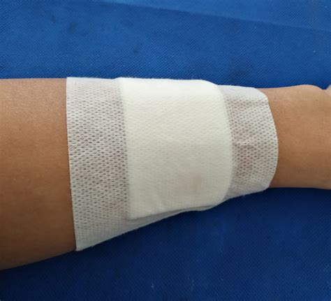 Hemostatic Bandage