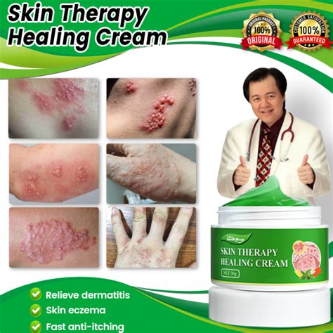 gamot sa kati kati sa balat atoderma cream original eczema psoriasis ...