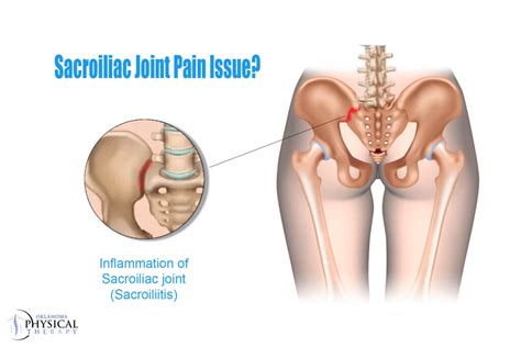 Sacroiliac Joint Pain