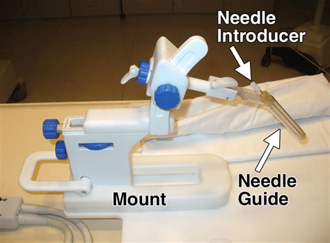 Imagingguided Prostate Biopsy Conventional And Emerging Techniques