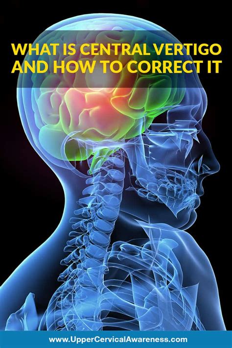 Knowing Central Vertigo & Correcting It | Upper Cervical Awareness