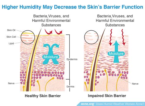 Does Humid Weather Worsen Acne? - Acne.org