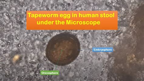 Tapeworm egg in human stool - YouTube