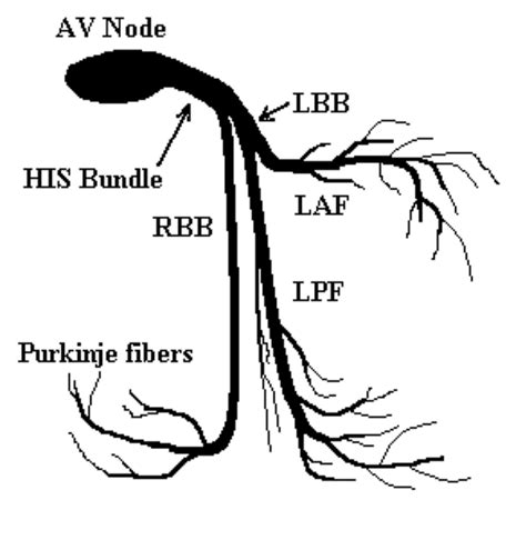 Left Anterior Fascicular Block (LAFB)