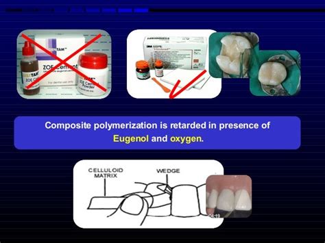 composite resin dental material