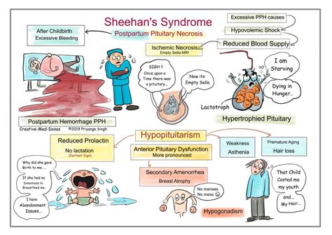 Sheehan's syndrome (Postpartum hypopituitarism) - Creative Med Doses