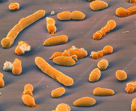 Klebsiella oxytoca bacteria - Stock Image - B220/1003 - Science Photo ...