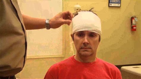 Bandaging Head Bandage - YouTube