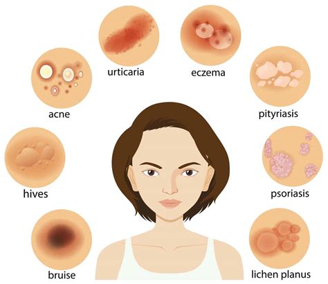 Diagram showing different skin conditions – Swiss Point of Care