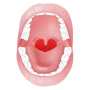 Check your Sore throat symptoms - Earlydoc symptomcheck