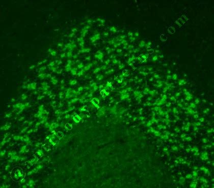 Glutamic Acid Decarboxylase (GAD) Antibodies - Biomarker News