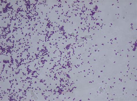 Staphylococcus saprophyticus - Wikispecies