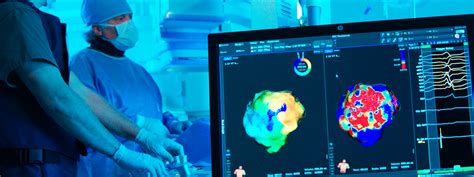 Complex Cardiac Arrhythmias Mapping – RHYTHMIA HDx - Boston Scientific