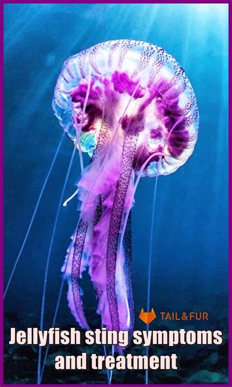 Jellyfish sting symptoms and treatment