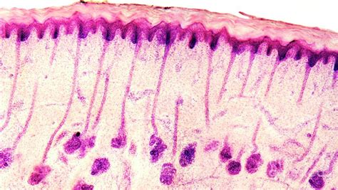 Skin Sweat Glands Photograph by Dr Keith Wheeler/science Photo Library