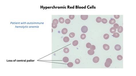 Red Cell Staining (Color) • The Blood Project